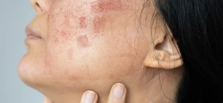 Diagnosis and Treatment of Skin Conditions Diagnosis and Treatment of Skin Conditions